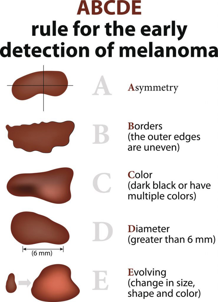 T1031-3-(BHH-ABCDE-Moles-Chart)_web